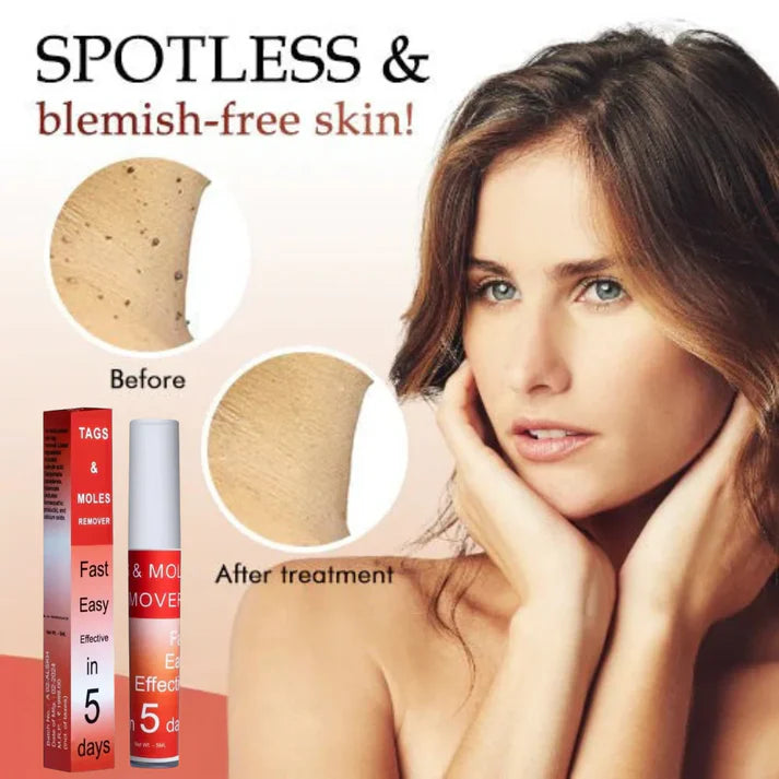 Tags & Moles Remover (Pack of 1)